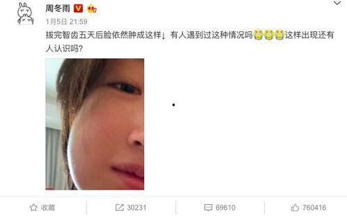 娱乐圈吃瓜爆料营销号,揭秘幕后推手与虚假信息泛滥  第2张