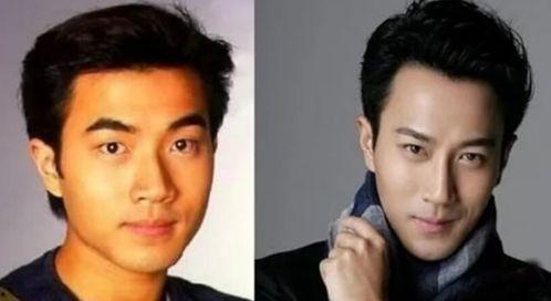 娱乐圈吃瓜爆料男星整容,男星整容真相大揭秘  第1张