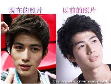 娱乐圈吃瓜爆料男星整容,男星整容真相大揭秘  第2张