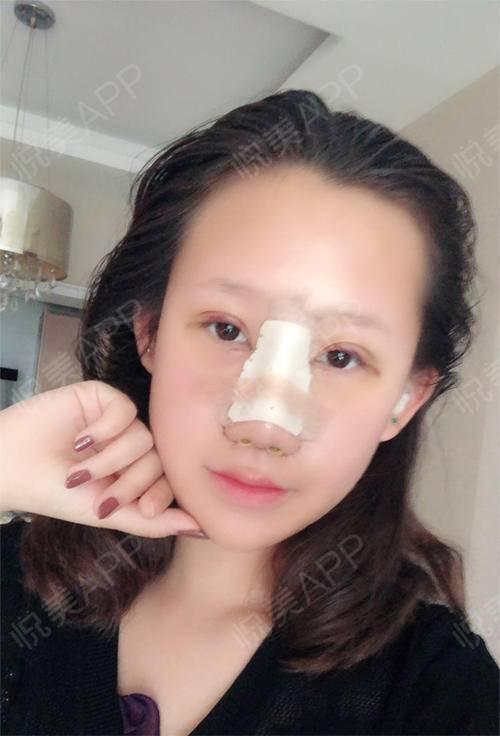 娱乐吃瓜酱不用做鼻子  第3张